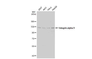 Anti-Integrin alpha 9 antibody [N1N2], N-term used in Western Blot (WB). GTX102728