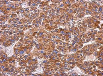 Anti-Integrin alpha 9 antibody [N1N2], N-term used in IHC (Paraffin sections) (IHC-P). GTX102728