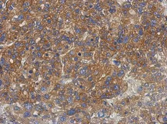 Anti-GS2 antibody used in IHC (Paraffin sections) (IHC-P). GTX102734