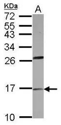 Anti-PLA2G1B antibody [N1C3] used in Western Blot (WB). GTX102749