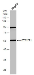 Anti-CYP17A1 antibody [N1C2] used in Western Blot (WB). GTX102753
