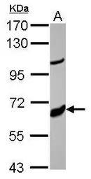 Anti-CYP17A1 antibody [N1C2] used in Western Blot (WB). GTX102753