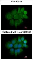 Anti-Cytokeratin 2 antibody [N2C2], Internal used in Immunocytochemistry/ Immunofluorescence (ICC/IF). GTX102758