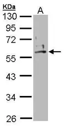 Anti-Cytokeratin 2 antibody [N2C2], Internal used in Western Blot (WB). GTX102758