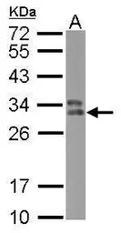 Anti-HLA-DPB1 antibody used in Western Blot (WB). GTX102763