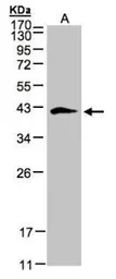Anti-Biglycan antibody used in Western Blot (WB). GTX102765