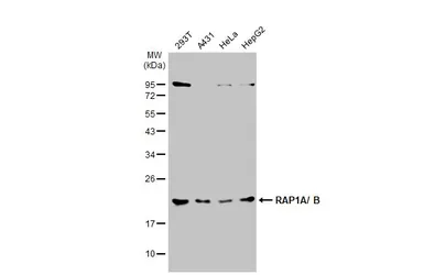 Anti-RAP1 antibody used in Western Blot (WB). GTX102770