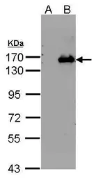 Anti-Peregrin antibody [N1N2], N-term used in Western Blot (WB). GTX102778