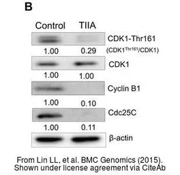 Anti-CDC25C antibody used in Western Blot (WB). GTX102809