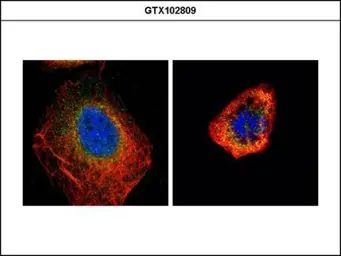 Anti-CDC25C antibody used in Immunocytochemistry/ Immunofluorescence (ICC/IF). GTX102809