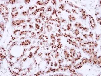 Anti-CDC25C antibody used in IHC (Paraffin sections) (IHC-P). GTX102809