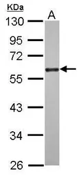 Anti-CDC25C antibody used in Western Blot (WB). GTX102809