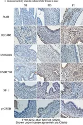 Anti-HSD3B2 antibody [N3C3] used in IHC (Paraffin sections) (IHC-P). GTX102813