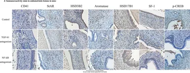 Anti-HSD3B2 antibody [N3C3] used in IHC (Paraffin sections) (IHC-P). GTX102813