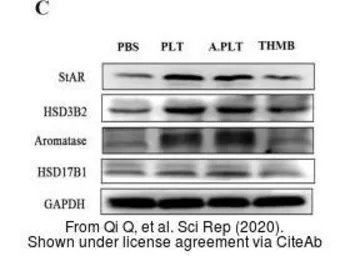 Anti-HSD3B2 antibody [N3C3] used in Western Blot (WB). GTX102813