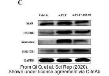 Anti-HSD3B2 antibody [N3C3] used in Western Blot (WB). GTX102813