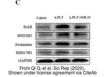 Anti-HSD3B2 antibody [N3C3] used in Western Blot (WB). GTX102813