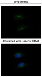 Anti-HSD3B2 antibody [N3C3] used in Immunocytochemistry/ Immunofluorescence (ICC/IF). GTX102813
