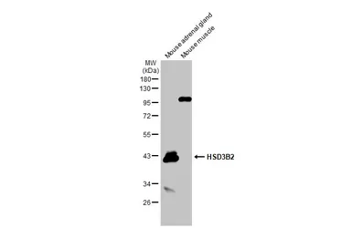 Anti-HSD3B2 antibody [N3C3] used in Western Blot (WB). GTX102813