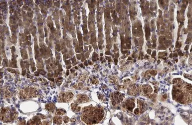 Anti-HSD3B2 antibody [N3C3] used in IHC (Paraffin sections) (IHC-P). GTX102813