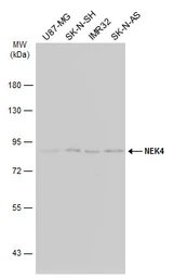 Anti-NEK4 antibody [N2C1], Internal used in Western Blot (WB). GTX102826