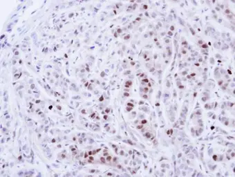 Anti-NEK4 antibody [N2C1], Internal used in IHC (Paraffin sections) (IHC-P). GTX102826