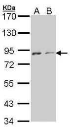 Anti-NEK4 antibody [N2C1], Internal used in Western Blot (WB). GTX102826