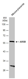 Anti-ARSB antibody [N3C3] used in Western Blot (WB). GTX102829