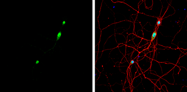 Anti-NOVA1 antibody used in Immunocytochemistry/ Immunofluorescence (ICC/IF). GTX102831