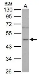 Anti-NOVA1 antibody used in Western Blot (WB). GTX102831