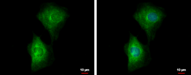Anti-PDE4B antibody used in Immunocytochemistry/ Immunofluorescence (ICC/IF). GTX102842