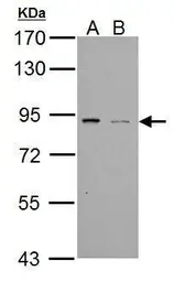 Anti-PDE4B antibody used in Western Blot (WB). GTX102845