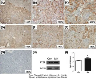 Anti-PTER antibody used in IHC (Paraffin sections) (IHC-P). GTX102860