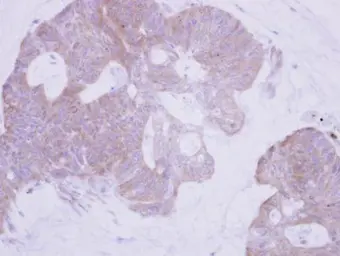 Anti-PTER antibody used in IHC (Paraffin sections) (IHC-P). GTX102860