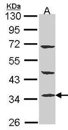 Anti-PTER antibody used in Western Blot (WB). GTX102860