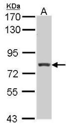 Anti-RFX3 antibody [N2C1], Internal used in Western Blot (WB). GTX102868