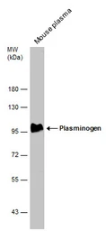 Anti-Plasminogen antibody used in Western Blot (WB). GTX102877