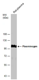 Anti-Plasminogen antibody used in Western Blot (WB). GTX102877