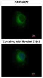 Anti-Plasminogen antibody used in Immunocytochemistry/ Immunofluorescence (ICC/IF). GTX102877