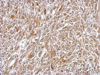 Anti-Plasminogen antibody used in IHC (Paraffin sections) (IHC-P). GTX102877