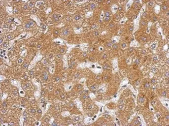 Anti-Plasminogen antibody used in IHC (Paraffin sections) (IHC-P). GTX102877