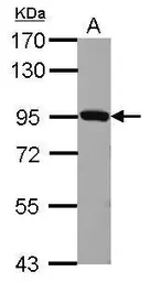 Anti-Plasminogen antibody used in Western Blot (WB). GTX102877