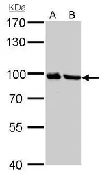 Anti-Plasminogen antibody used in Western Blot (WB). GTX102877
