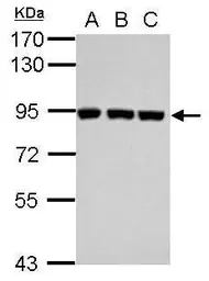 Anti-Plasminogen antibody used in Western Blot (WB). GTX102877