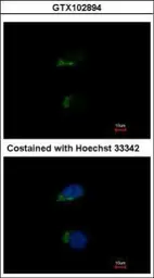 Anti-JIK antibody [N2C2], Internal used in Immunocytochemistry/ Immunofluorescence (ICC/IF). GTX102894