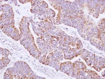 Anti-JIK antibody [N2C2], Internal used in IHC (Paraffin sections) (IHC-P). GTX102894