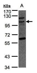 Anti-JIK antibody [N2C2], Internal used in Western Blot (WB). GTX102894