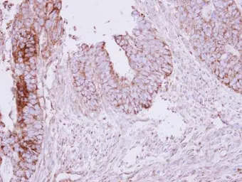 Anti-MCC antibody [N1N3] used in IHC (Paraffin sections) (IHC-P). GTX102911