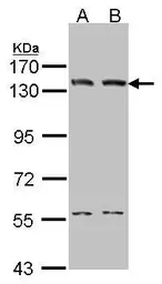 Anti-DNA ligase I antibody [C2C3], C-term used in Western Blot (WB). GTX102936