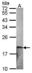 Anti-ET-2 antibody [N1C3] used in Western Blot (WB). GTX102946